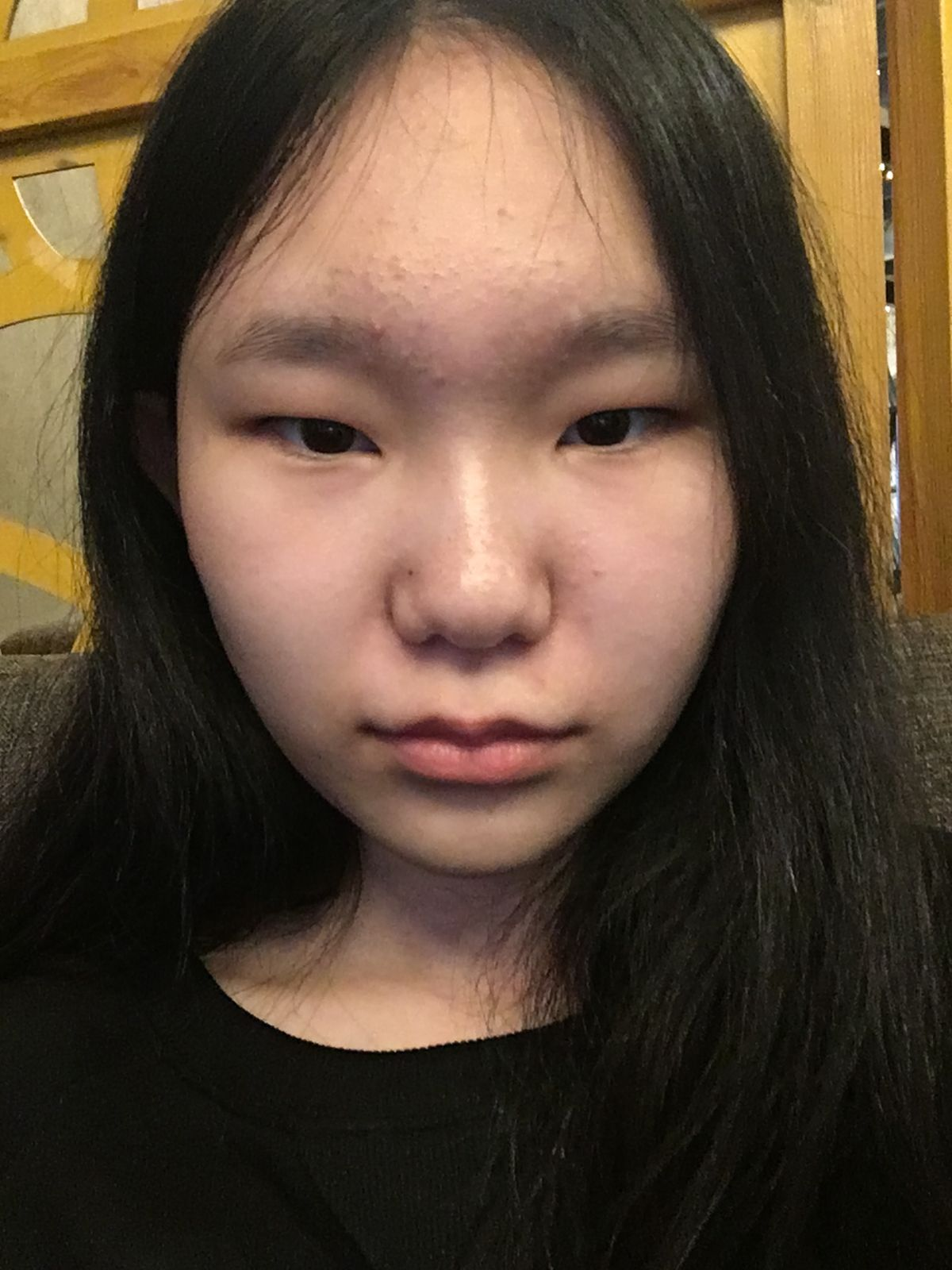 Before - Normal Selfie